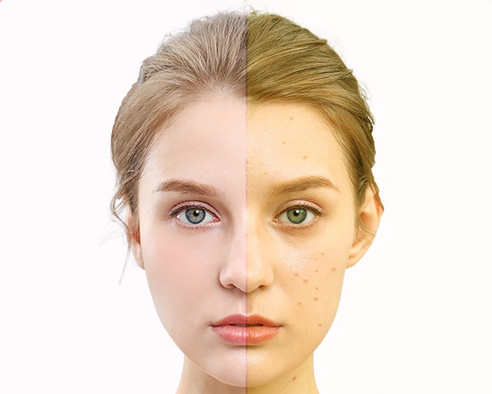 LED Photon Therapy Mask – Anti-Aging & Skin Rejuvenation